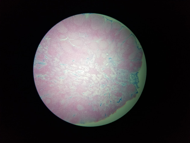 Reticular Connective Slides - Reticular Connective 01 40X